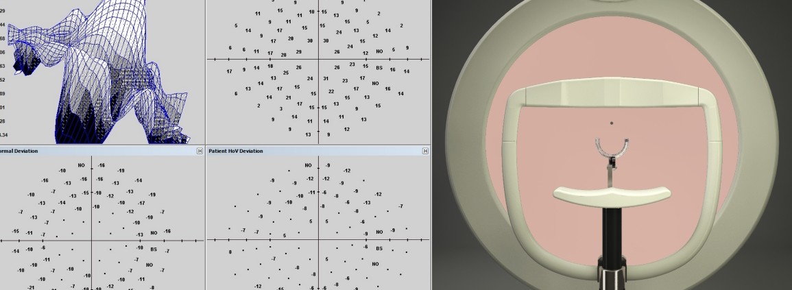 Visual_fields