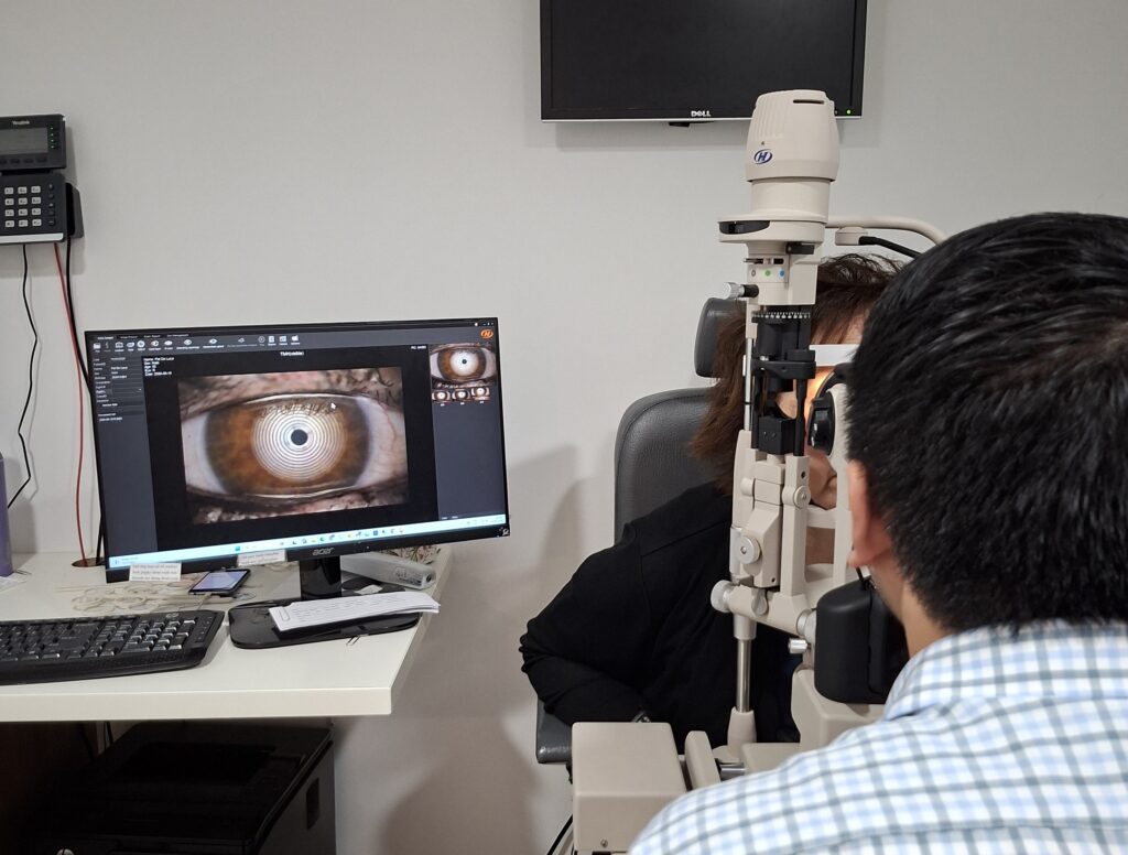 Dry eye analyser
